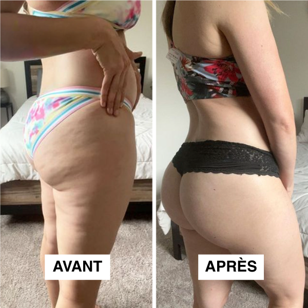 Redu Sculpt™ – Ton Corps, Tes Courbes, Ta Confiance
