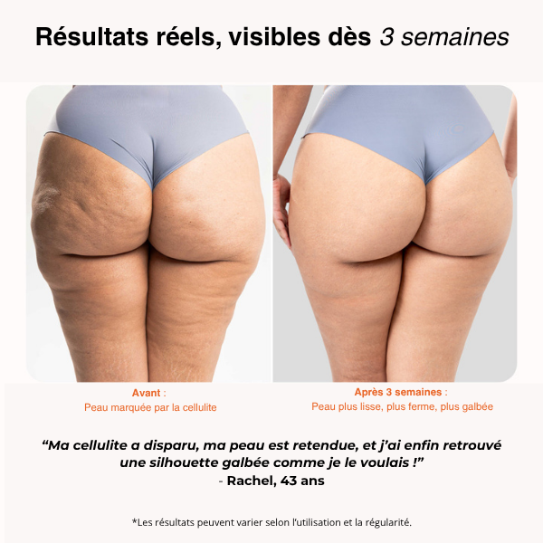 Redu Sculpt™ – Ton Corps, Tes Courbes, Ta Confiance