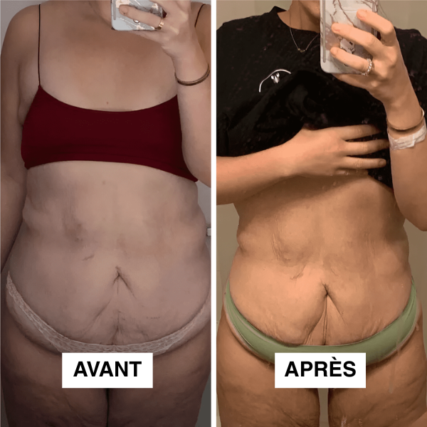 Redu Sculpt™ – Ton Corps, Tes Courbes, Ta Confiance