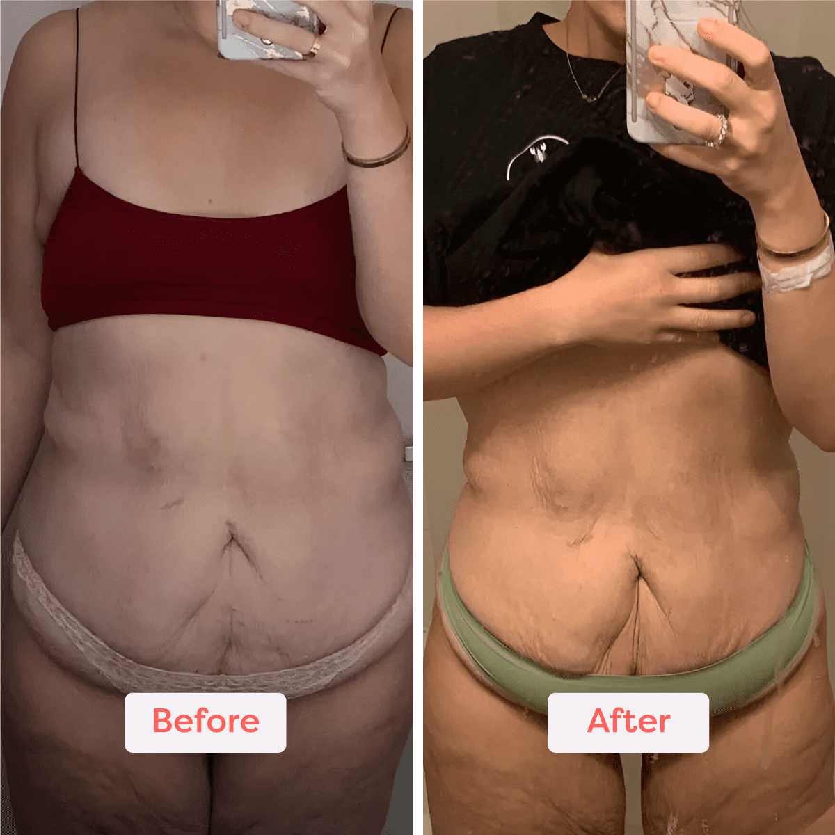 Slim’Glow™ – Le Rituel Sculptant Révélateur de Courbes