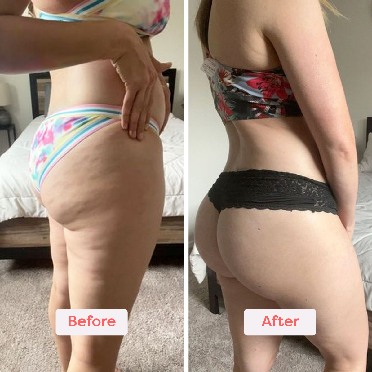 Slim’Glow™ – Le Rituel Sculptant Révélateur de Courbes