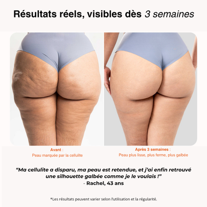 Redu Sculpt™ – Ton Corps, Tes Courbes, Ta Confiance