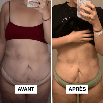 Redu Sculpt™ – Ton Corps, Tes Courbes, Ta Confiance