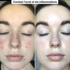 Résultat soin visage avant après pour une peau plus nette et lumineuse