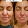 Avant après soin visage pour une peau visiblement plus fraîche