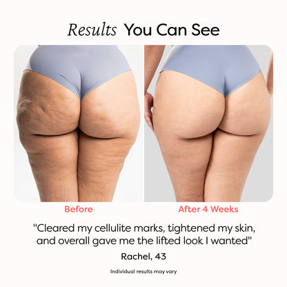 Slim’Glow™ – Le Rituel Sculptant Révélateur de Courbes