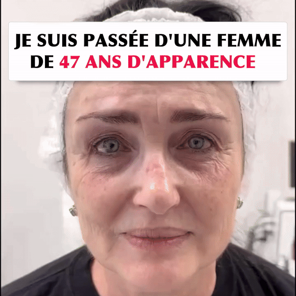 Anti-rides et Anti-cerne numéro 1 au Sénégal 🇸🇳